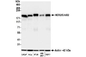 Western Blotting (WB) image for anti-Receptor tyrosine-protein kinase erbB-2 (ErbB2/Her2) (AA 1205-1255) antibody (ABIN7455181) (Rekombinanter ErbB2/Her2 Antikörper  (AA 1205-1255))