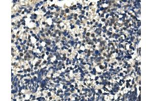 IHC analysis of ULK1 using anti-ULK1 antibody (ABIN7602755). (ULK1 Antikörper  (C-Term))