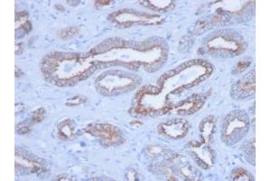 Formalin-fixed, paraffin-embedded human Prostate stained with Pan-Cytokeratin Mouse Monoclonal Antibody (PCK/3150). (KRT Antikörper)