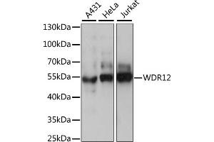 Western blot analysis of extracts of various cell lines, using WDR12 antibody (ABIN7271353) at 1:1000 dilution. (WDR12 Antikörper  (AA 1-280))