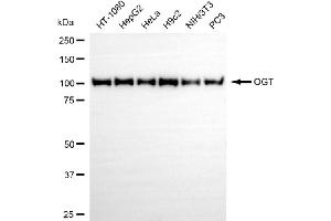 Western blotting analysis using OGT antibody (ABIN7799694).