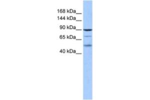 Western Blotting (WB) image for anti-Hairless (HR) antibody (ABIN2460608) (Hairless Antikörper)