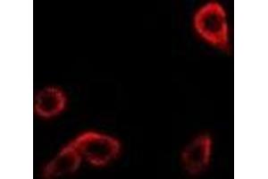 Immunofluorescent analysis of RRM1 staining in Hela cells. (RRM1 Antikörper)