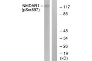 Western blot analysis of extracts from LOVO cells, using NMDAR1 (Phospho-Ser897) Antibody. (GRIN1/NMDAR1 Antikörper  (pSer897))