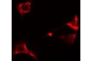 ABIN6274949 staining A549  cells by IF/ICC. (CLIP3 Antikörper  (Internal Region))