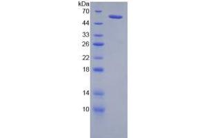 SDS-PAGE analysis of Rat Neuropilin 2 Protein. (NRP2 Protein)