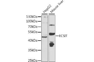 Western blot analysis of extracts of various cell lines, using ECSIT antibody (ABIN6130352, ABIN6139923, ABIN6139924 and ABIN6223767) at 1:1000 dilution. (ECSIT Antikörper  (AA 50-296))