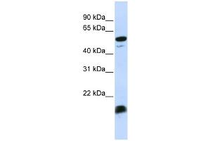 WB Suggested Anti-C4BPA Antibody Titration:  0. (C4BPA Antikörper  (Middle Region))