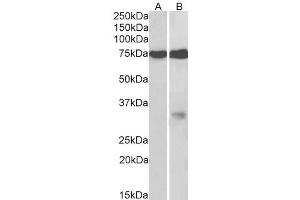 ABIN571279 (2µg/ml) staining of fetal Mouse (A) and Rat (B) Brain lysates (35µg protein in RIPA buffer).