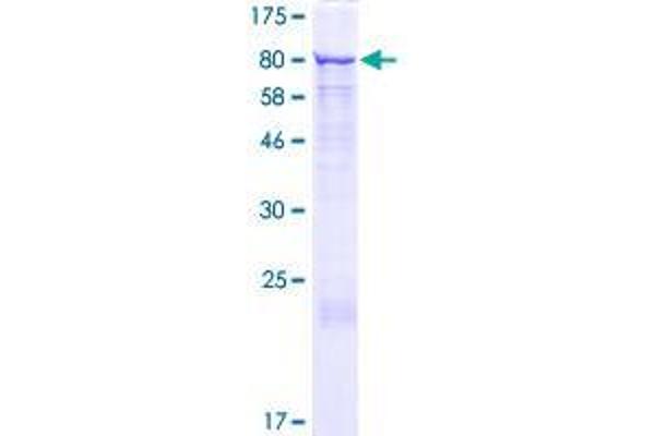 GRHL2 Protein (AA 1-625) (GST tag)