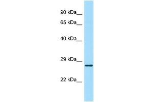 Host: Rabbit Target Name: ABHD14A Sample Type: Fetal Kidney lysates Antibody Dilution: 1.