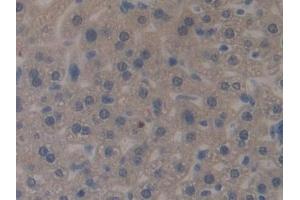 Detection of MUC1 in Mouse Liver Tissue using Polyclonal Antibody to Mucin 1 (MUC1) (MUC1 Antikörper  (AA 474-630))