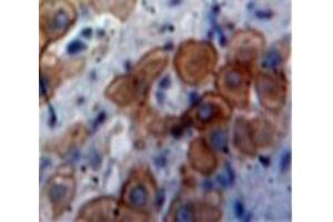 IHC-P analysis of Liver tissue, with DAB staining. (CXCL11 Antikörper  (AA 22-94))