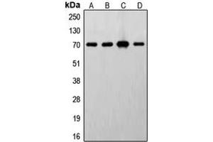Western blot analysis of S6K1 expression in MCF7 (A), HeLa (B), MDCK (C), mouse brain (D) whole cell lysates. (RPS6KB1 Antikörper  (C-Term))