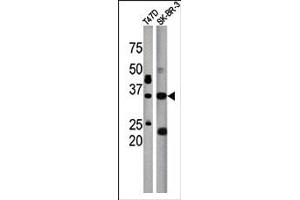 Image no. 1 for anti-Isoprenylcysteine Carboxyl Methyltransferase (ICMT) (C-Term) antibody (ABIN357792) (ICMT Antikörper  (C-Term))