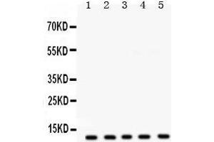 FXYD1 Antikörper  (AA 21-92)