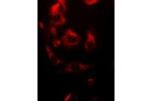 Immunofluorescent analysis of NDUFV1 staining in A549 cells. (NDUFV1 Antikörper)
