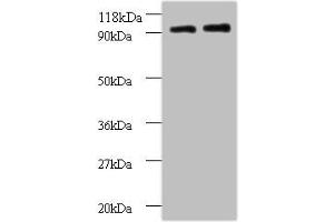 Western blot All lanes: RPS12 antibody at 2 μg/mL Lane 1: EC109 whole cell lysate Lane 2: 293T whole cell lysate Secondary Goat polyclonal to rabbit IgG at 1/15000 dilution Predicted band size: 15 kDa Observed band size: 90 kDa (RPS12 Antikörper  (AA 1-132))