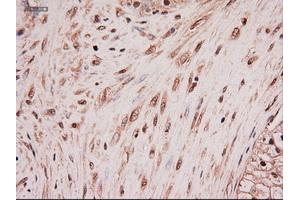 Immunohistochemical staining of paraffin-embedded colon using anti-NTF4 (ABIN2452547) mouse monoclonal antibody. (Neurotrophin 4 Antikörper  (AA 81-210))