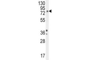 Western Blotting (WB) image for anti-Dopamine beta-Hydroxylase (Dopamine beta-Monooxygenase) (DBH) (AA 27-56) antibody (ABIN3030763)