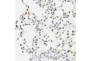 Immunohistochemistry (Paraffin-embedded Sections) (IHC (p)) image for anti-Endothelial Differentiation Related Factor 1 (EDF1) (AA 1-148) antibody (ABIN1679646)