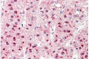 Immunohistochemistry (IHC) image for anti-Proteasome (Prosome, Macropain) 26S Subunit, Non-ATPase, 1 (PSMD1) (AA 251-300) antibody (ABIN6752998)