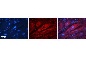 Rabbit Anti-SLC26A3 Antibody  Catalog Number: ARP31608_P050 Formalin Fixed Paraffin Embedded Tissue: Human Adult heart  Observed Staining: Membrane Primary Antibody Concentration: 1:100 Secondary Antibody: Donkey anti-Rabbit-Cy2/3 Secondary Antibody Concentration: 1:200 Magnification: 20X Exposure Time: 0. (SLC26A3 Antikörper  (Middle Region))