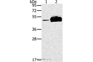 Western blot analysis of K562 cell and human testis tissue, using PTPN20B Polyclonal Antibody at dilution of 1:200 (PTPN20 Antikörper)