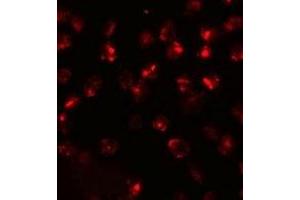 Immunofluorescencent staining of 3T3 cells with ATP2C2 polyclonal antibody  at 20 ug/mL.
