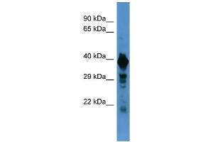 Western Blotting (WB) image for anti-Solute Carrier Family 18 (Vesicular Monoamine Transporter), Member 1 (SLC18A1) (N-Term) antibody (ABIN2505523) (SLC18A1 Antikörper  (N-Term))