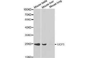 Western blot analysis of extracts of various cell lines, using UCP3 antibody. (UCP3 Antikörper  (AA 1-110))
