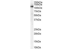 Image no. 1 for anti-USO1 Homolog, Vesicle Docking Protein (USO1) (C-Term) antibody (ABIN374624) (USO1 Antikörper  (C-Term))
