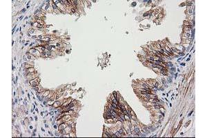 Immunohistochemical staining of paraffin-embedded Human prostate tissue using anti-CDCP1 mouse monoclonal antibody. (CDCP1 Antikörper)