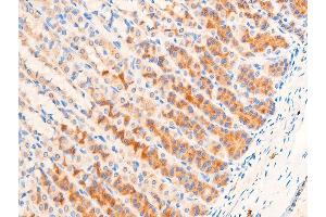 Immunohistochemistry (IHC) image for anti-Transforming Growth Factor, beta 1 (TGFB1) (C-Term) antibody (ABIN6266431)