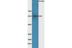Western Blotting (WB) image for anti-Interleukin 1 Receptor, Type I (IL1R1) (pTyr496) antibody (ABIN801423)