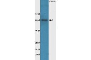 Lane 1: mouse intestinal lysate probed with Rabbit Anti-IL-1R1(Tyr496) Polyclonal Antibody, Unconjugated  at 1:5000 for 90 min at 37˚C.