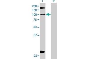 Western Blot analysis of KIAA1967 expression in transfected 293T cell line by KIAA1967 MaxPab polyclonal antibody. (CCAR2 Antikörper  (AA 1-923))