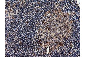 Image no. 3 for anti-EPM2A (Laforin) Interacting Protein 1 (EPM2AIP1) antibody (ABIN1498046) (EPM2AIP1 Antikörper)