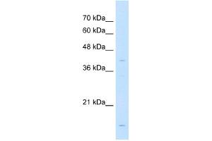 WB Suggested Anti-LMAN2 Antibody Titration:  1 ug/ml  Positive Control:  Jurkat cell lysate (LMAN2 Antikörper  (N-Term))