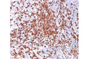 IHC testing of human tonsil stained with HCAM antibody (156-3C11). (CD44 Antikörper)