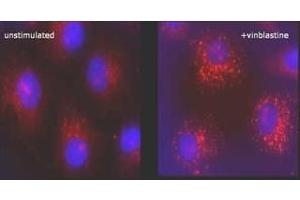 Immunofluorescence (IF) image for anti-Microtubule-Associated Protein 1 Light Chain 3 beta (MAP1LC3B) (N-Term) antibody (ABIN492614) (LC3B Antikörper  (N-Term))
