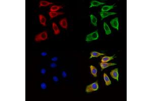 ABIN7094888 and ABIN7098941 staining Hela cells by IF/ICC. (IL21 Receptor Antikörper  (Internal Region))