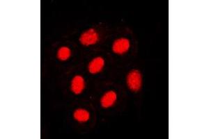 Immunofluorescent analysis of HNF4 alpha (pS313) staining in SW480 cells. (HNF4A Antikörper  (pSer313))