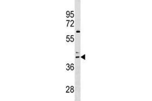 CCR4 antibody western blot analysis in HL-60 lysate (CCR4 Antikörper  (AA 262-290))
