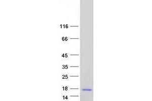 Western Blotting (WB) image for Keratinocyte Differentiation-Associated Protein (KRTDAP) protein (Myc-DYKDDDDK Tag) (ABIN2724139)