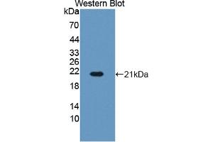 Figure. (Hemoglobin Subunit beta Antikörper  (AA 1-145))
