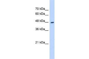 WB Suggested Anti-HADHB Antibody Titration:  0. (HADHB Antikörper  (C-Term))