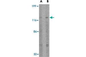 Western blot analysis of SLITRK3 in SK-N-SH cell lysate with SLITRK3 polyclonal antibody  at (A) 0.