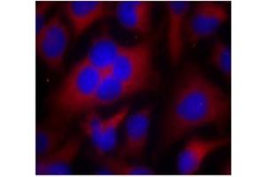 Image no. 2 for anti-Cyclin-Dependent Kinase 1 (CDK1) (Thr161) antibody (ABIN197352) (CDK1 Antikörper  (Thr161))