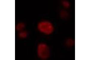 ABIN6274322 staining LOVO cells by IF/ICC. (SRSF4 Antikörper  (Internal Region))